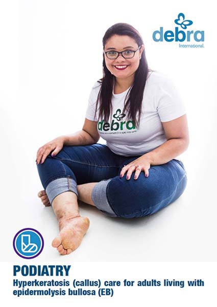 Capa do “PODIATRY - Hyperkeratosis (callus) care for adults living with epidermolysis bullosa (EB)”