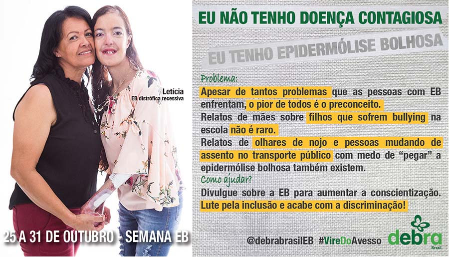 Um dos 7 banners que a DEBRA Brasil criou abordando os problemas que as pessoas com EB enfrentam e como podemos ajudá-las. A mãe da Letícia, jovem com EB distrófica recessiva, está segurando as suas mãos e as duas tem os rostos colados. O tema abordado é “Eu não tenho doença contagiosa, eu tenho epidermólise bolhosa”.