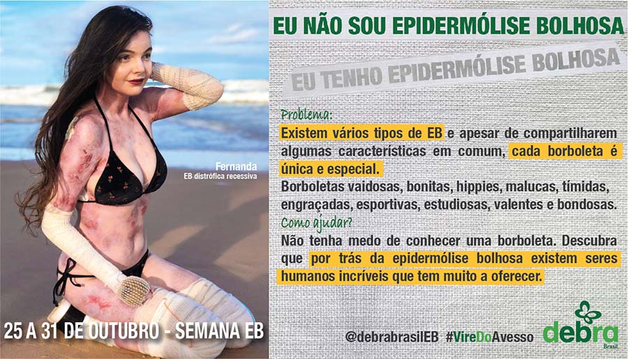 Um dos 7 banners que a DEBRA Brasil criou abordando os problemas que as pessoas com EB enfrentam e como podemos ajudá-las. A Nanda Tanajura, jovem com EB distrófica recessiva, está na praia de biquini e com algumas ataduras. O tema abordado é “Eu não sou epidermólise bolhosa, eu tenho epidermólise bolhosa”.