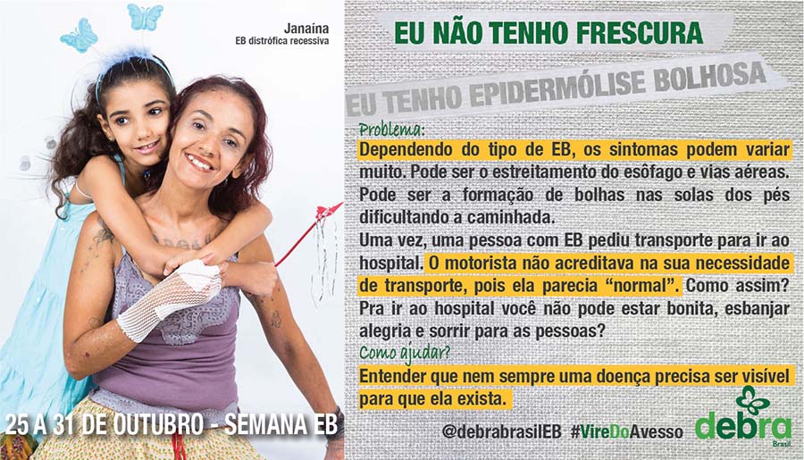Um dos 7 banners que a DEBRA Brasil criou abordando os problemas que as pessoas com EB enfrentam e como podemos ajudá-las. Janaína, mulher com EB distrófica recessiva, está abraçada com a filha e o tema abordado é “Eu não tenho frescura, eu tenho epidermólise bolhosa”.