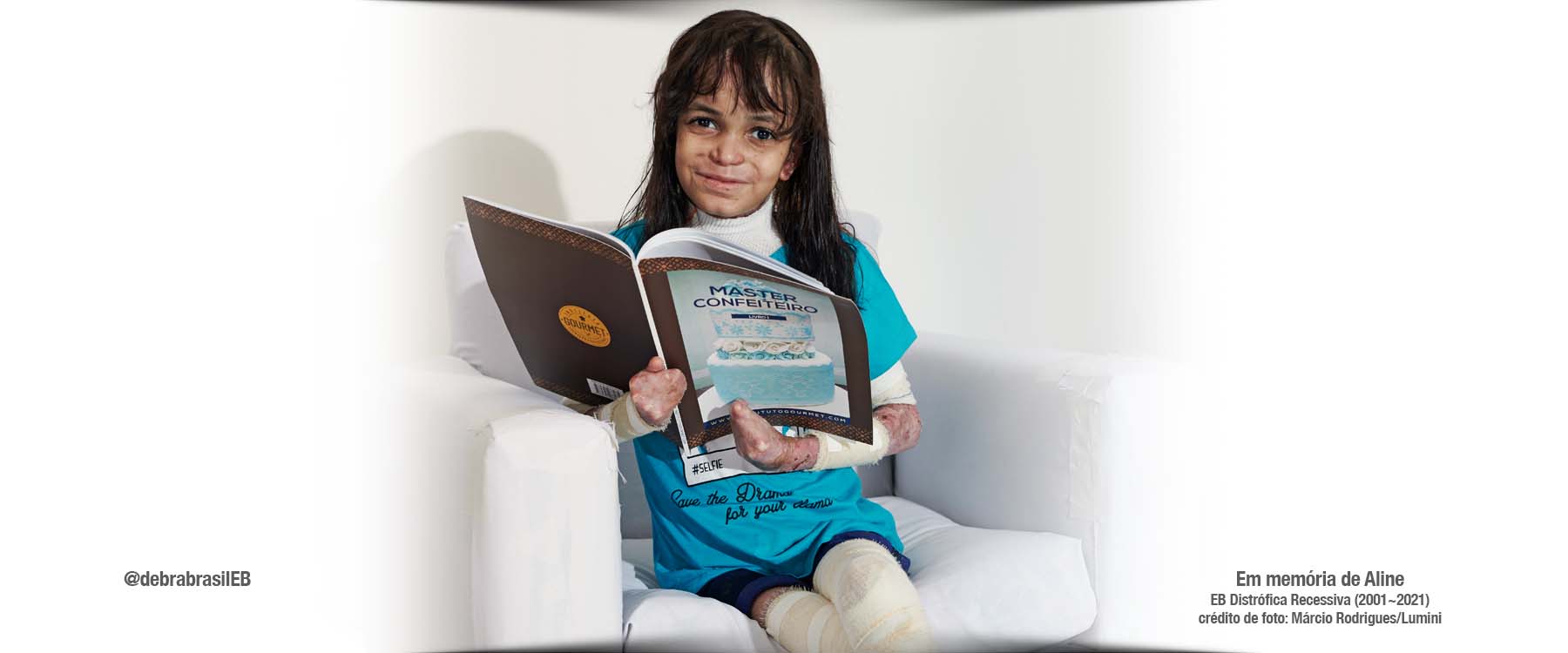 Aline, jovem com epidermólise bolhosa (EB) distrófica recessiva, sentada com o livro “Master Confeiteiro” nas mãos