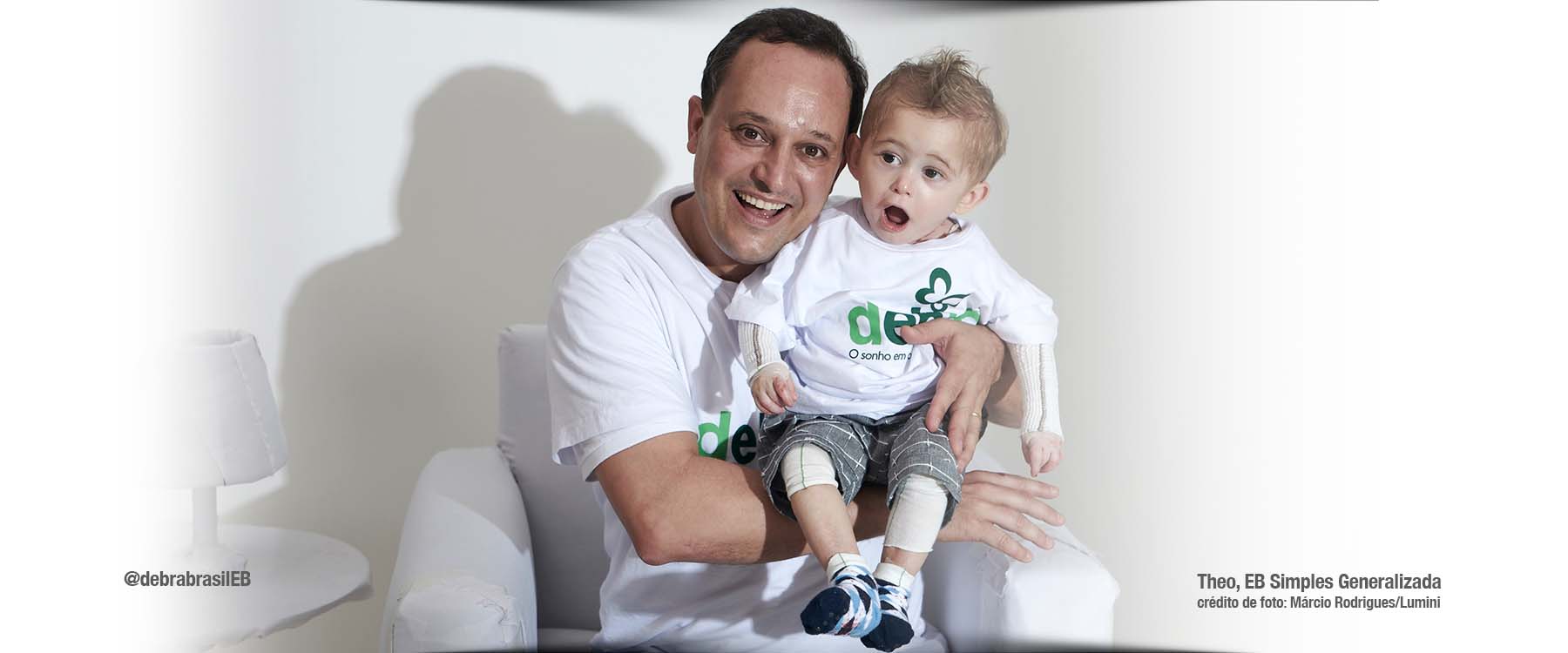 Theo, bebê com epidermólise bolhosa (EB) simples generalizada, com curativos nos dois braços e nos joelhos, sorrindo no colo do seu tio Leandro, presidente da DEBRA