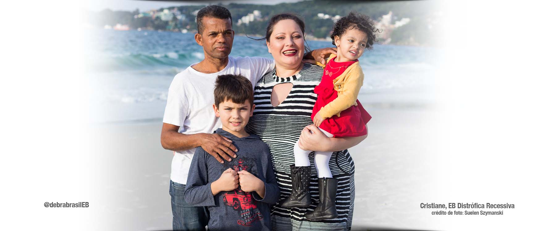 Cristiane, uma mulher com epidermólise bolhosa distrófica recessiva (EB), com o esposo, o filho pequeno e segurando a sua filha pequena no colo