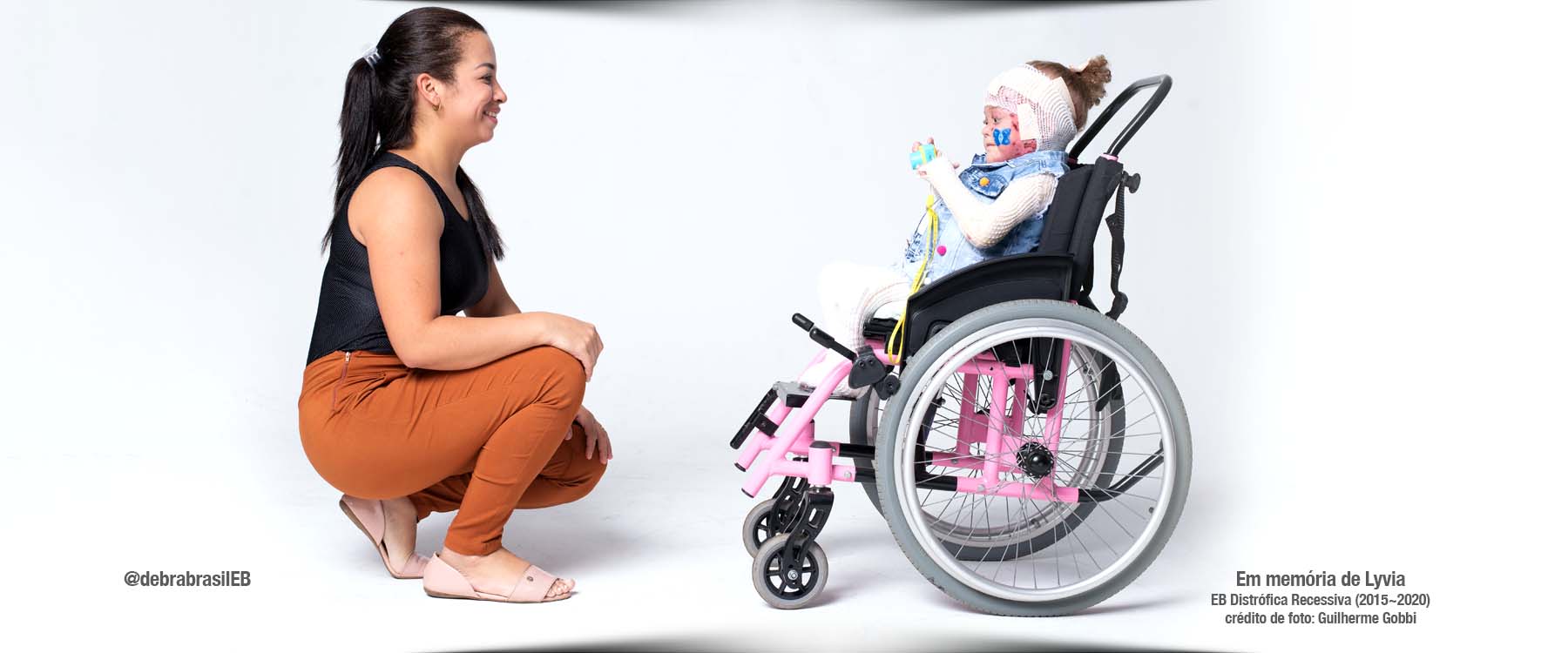 A Lyvia, menina com epidermólise bolhosa (EB) distrófica recessiva, segura uma câmera de brinquedo enquanto sua mãe sorri para ela 
