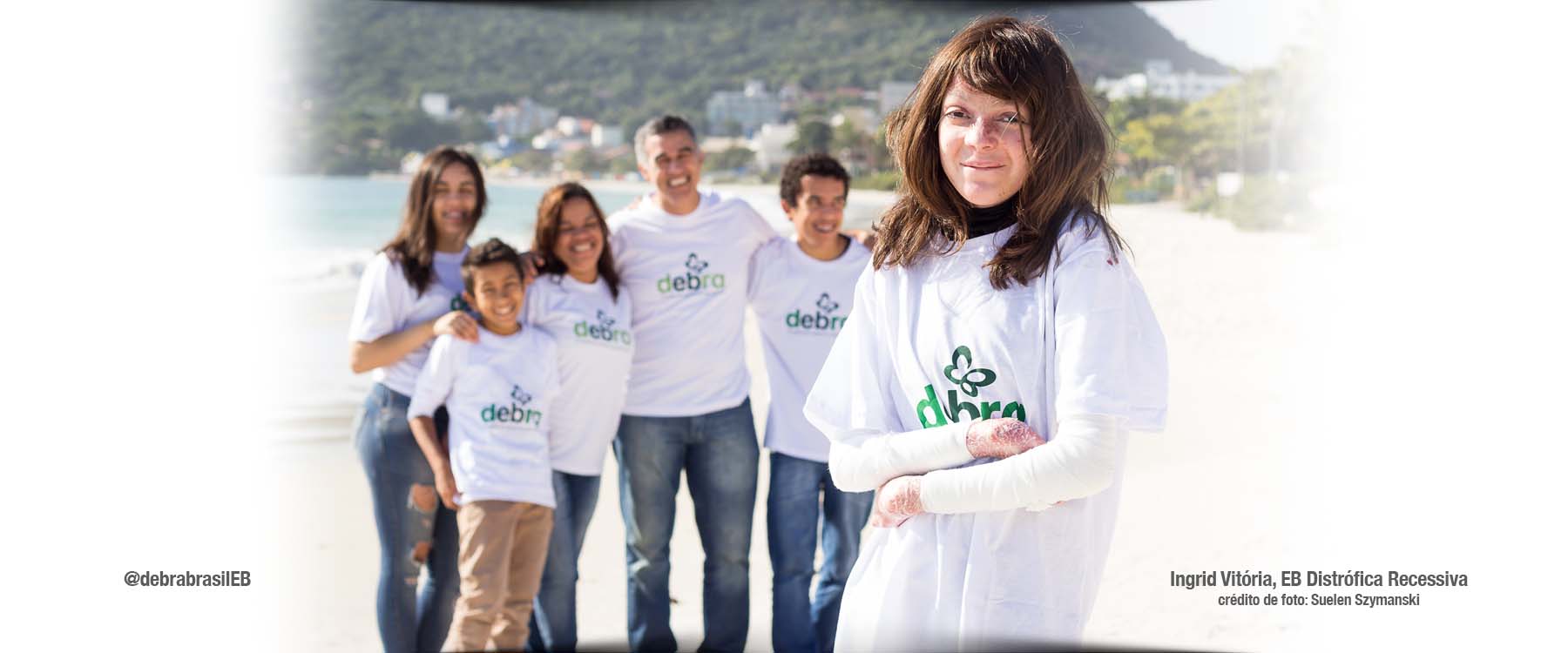Ingrid Vitória, jovem com epidermólise bolhosa (EB) distrófica recessiva, principal modelo da foto com a família no fundo
