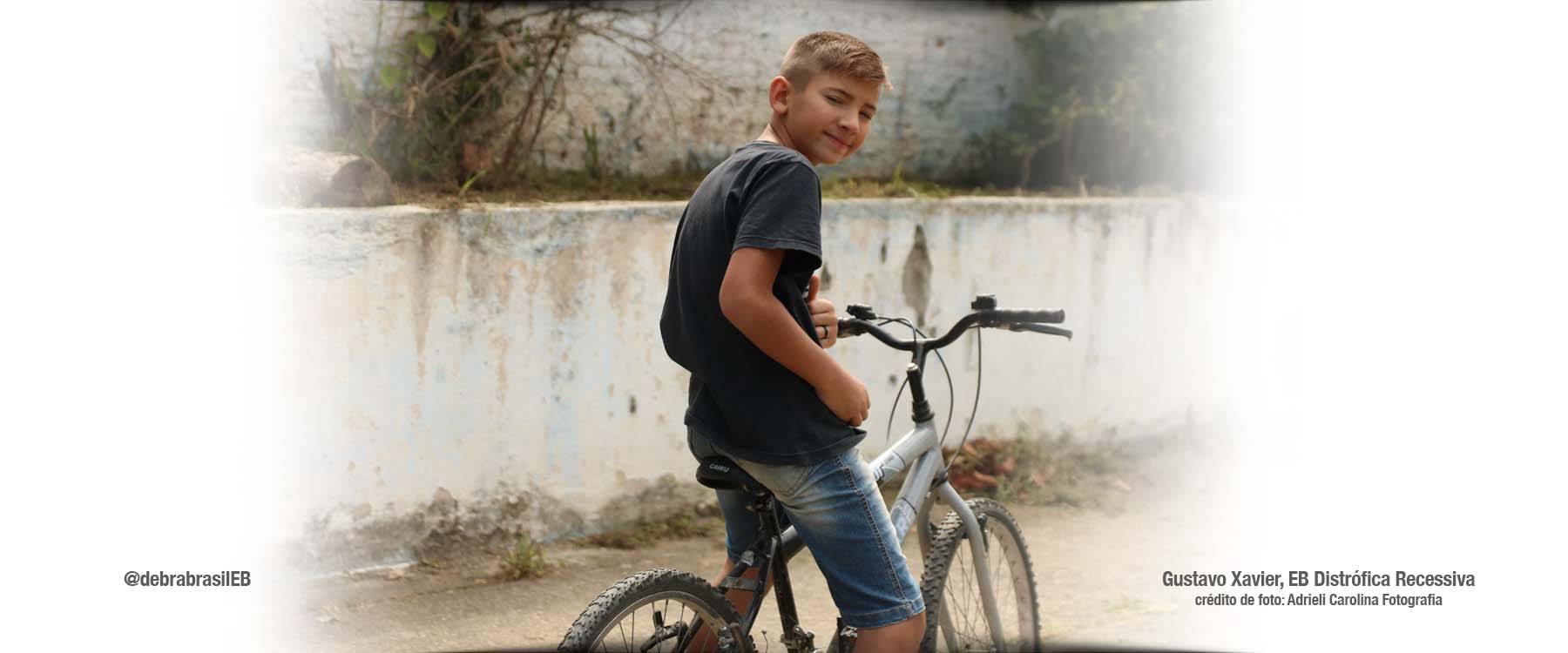 Gustavo Xavier, pré-adolescente com epidermólise bolhosa (EB) distrófica recessiva, sentado em uma bicicleta