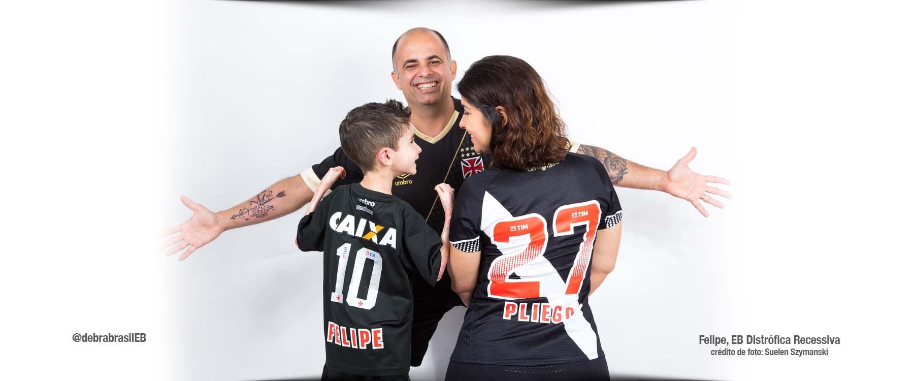 Felipe, um menino com epidermólise bolhosa (EB) distrófica recessiva com a mãe e o pai, todos vestindo a camiseta do Vasco da Gama