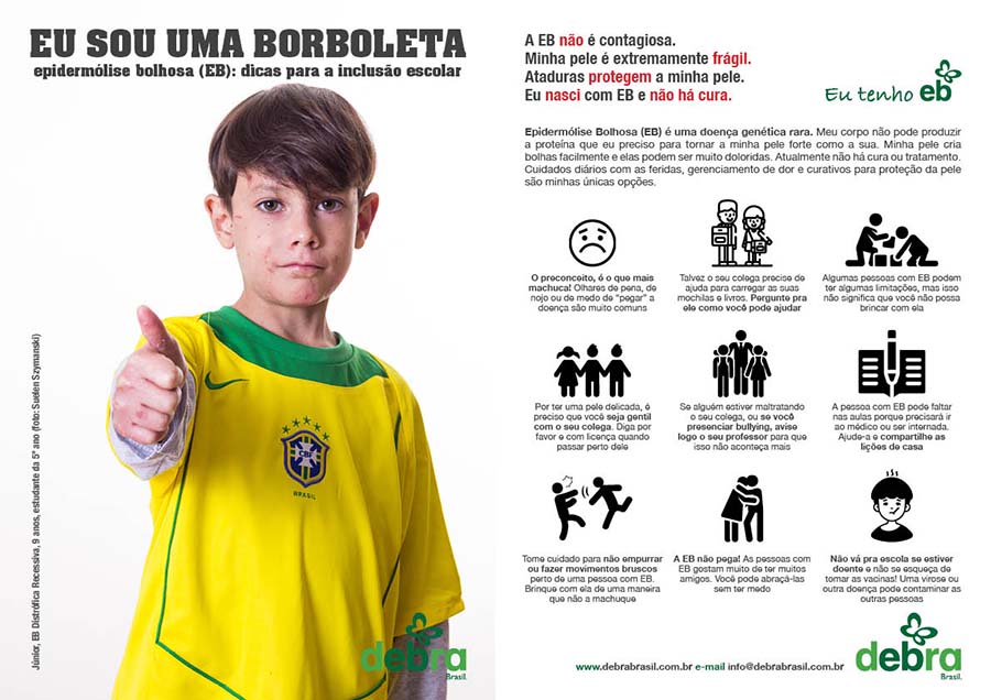 Flyer para divulgação da EB na escola. Metade do flyer tem a foto do Júnior, menino com epidermólise bolhosa distrófica recessiva (EB), com a camiseta da seleção brasileira 