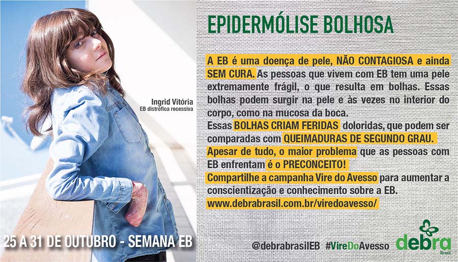 Um dos 7 banners que a DEBRA Brasil criou para a conscientização da epidermólise bolhosa durante a semana EB. Ingrid Vitória, jovem com EB distrófica recessiva, é a modelo do banner e o tema abordado é sobre a epidermólise bolhosa.