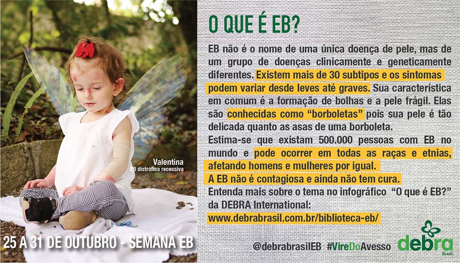 Um dos 7 banners que a DEBRA Brasil criou para a conscientização da epidermólise bolhosa durante a semana EB. Valentina, bebê com EB distrófica recessiva, é a modelo do banner e o tema abordado é “O que é EB?”