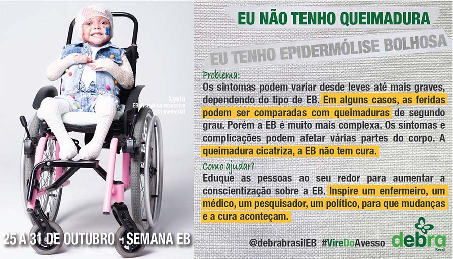 Um dos 7 banners que a DEBRA Brasil criou abordando os problemas que as pessoas com EB enfrentam e como podemos ajudá-las. Em memória de Lyvia, menina com EB distrófica recessiva, que está sentada numa cadeira de rodas cor de rosa. O tema abordado é “Eu não tenho queimadura, eu tenho epidermólise bolhosa”.