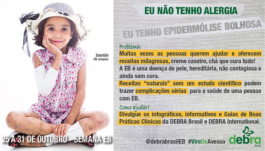 Um dos 7 banners que a DEBRA Brasil criou abordando os problemas que as pessoas com EB enfrentam e como podemos ajudá-las. A Iasmin, menina com EB simples, parece uma modelo, com pose de uma profissional. O tema abordado é “Eu não tenho alergia, eu tenho epidermólise bolhosa”.