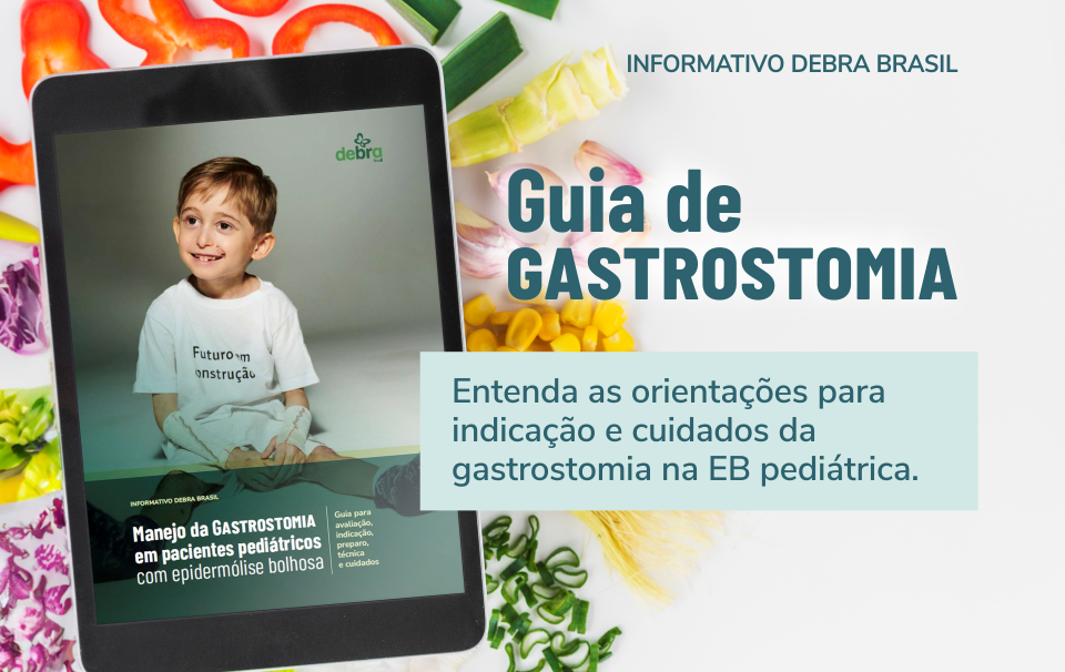 Manejo da Gastrostomia em pacientes pediátricos com epidermólise bolhosa Guia para avaliação, indicação, preparo, técnica e cuidados