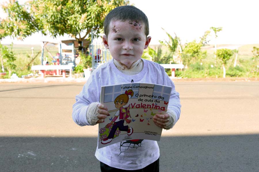 Matheus, criança com epidermólise bolhosa (EB), mostra orgulhoso o livro da Valentina que ele recebeu da Tatiane